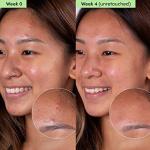 Sand & Sky Oil Control Clay Mask for Blemishes