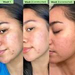 Sand & Sky Oil Control Clay Mask for Blemishes