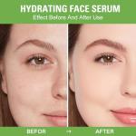 5-Piece Aloe Vera Hydrating Face Mask Set