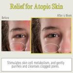 Hydrating Recovery Mud Mask for Deep Cleansing