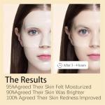 Collagen Face Mask Set for Anti-Aging Care