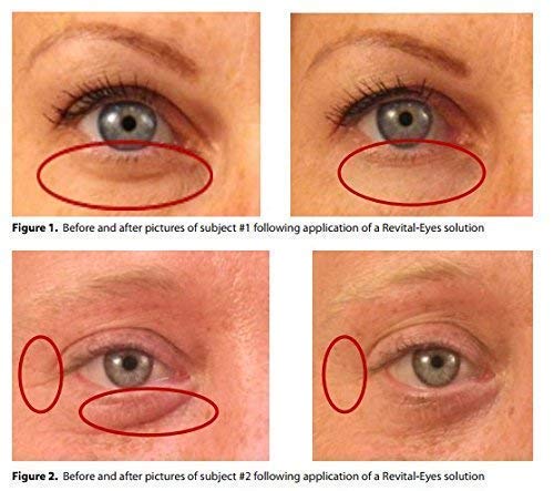 Lunar Glow Brightening Under Eye Serum 10ml