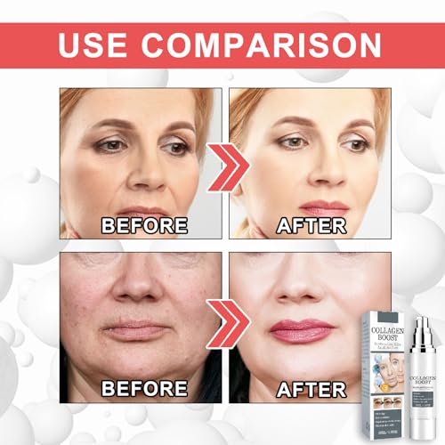 Collagen Boost Anti-Aging Serum for Youthful Skin
