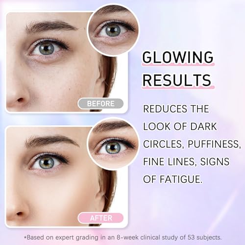 Caffeine Eye Cream and Serum Kit for Dark Circles