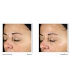 RoC Revive + Glow Daily Vitamin C Serum