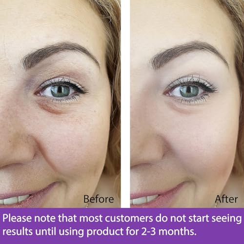 Retinol Moisturizer Cream for Youthful Skin