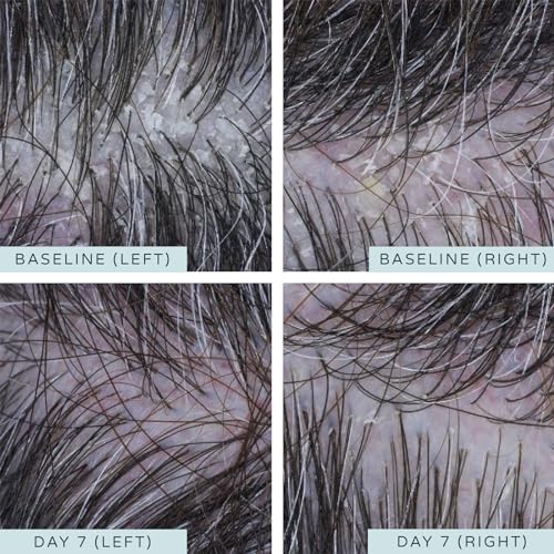 Ameliorate Scalp Serum with Oat Oil & AHAs