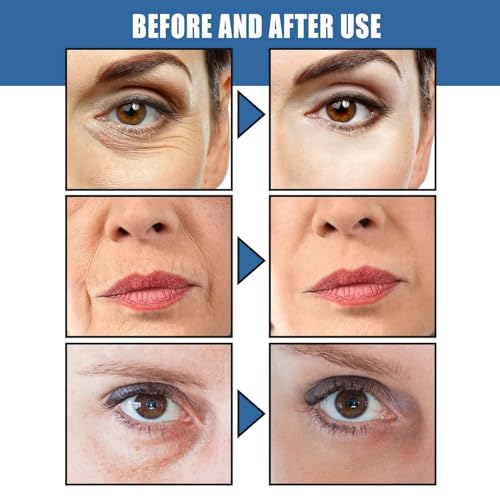 Retinol Collagen Anti-Aging Cream with Hyaluronic Acid