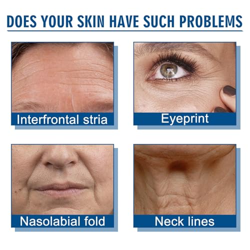 Retinol Collagen Anti-Aging Cream with Hyaluronic Acid