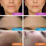 Retinol, Vitamin C & Hyaluronic Acid Serum Set