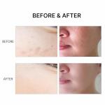 MAYCOOP Hydrating Essence Toner for Youthful Skin