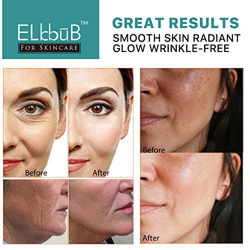 Vitamin C & Retinol Anti-Aging Serum for Face