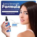 5% Minoxidil Hair Growth Spray for Men and Women