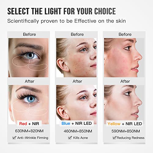 IBORRIA Red Light Therapy Face Mask