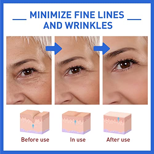 Hydrating Botox Facial Serum for Youthful Skin