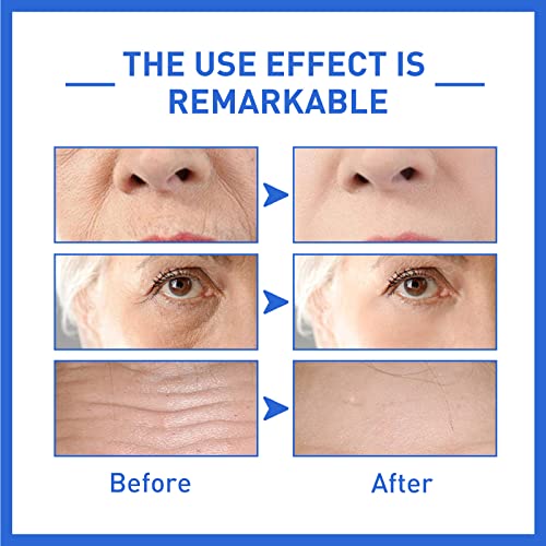 Hydrating Botox Facial Serum for Youthful Skin