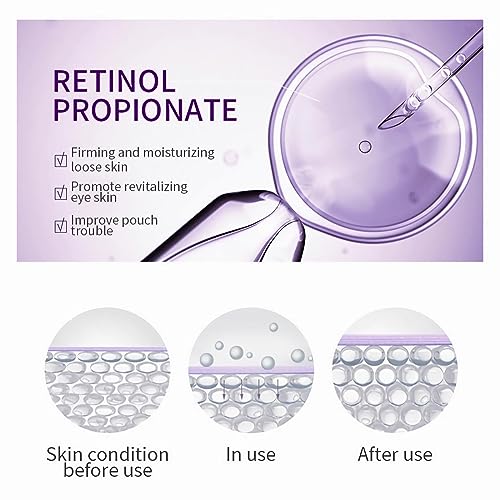 Retinol Eye Cream for Dark Circles & Puffiness