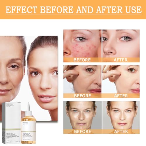 Glycolic Acid 7% Toner for Youthful Skin