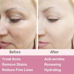 Retinol Moisturizer Cream for Anti-Aging & Skin Care