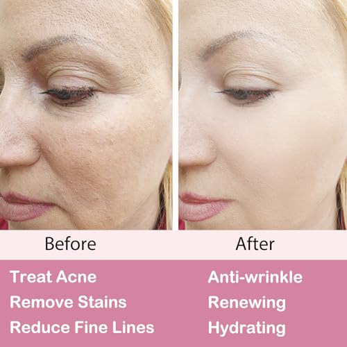 Retinol Moisturizer Cream for Anti-Aging & Skin Care