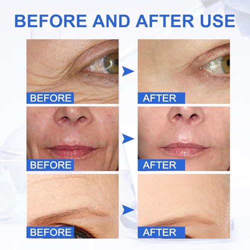 Anti-Aging Boto-x Facial Serum for Youthful Skin