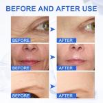 Anti-Aging Boto-x Facial Serum for Youthful Skin