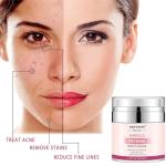 Retinol Moisturizer Cream for Anti-Aging & Skin Care