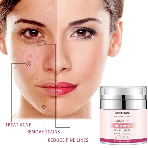 Retinol Moisturizer Cream for Anti-Aging & Skin Care