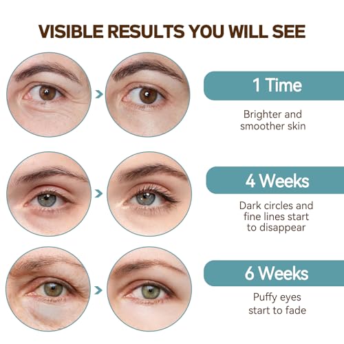 Caffeine Eye Serum for Dark Circles and Puffiness