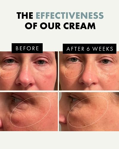 Eclat Under Eye Cream for Dark Circles & Puffiness