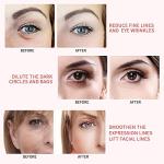 Retimax 1500 Retinol Anti-Aging Ointment, 30g