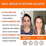 ViolaSkin Vitamin C Serum for Youthful Skin