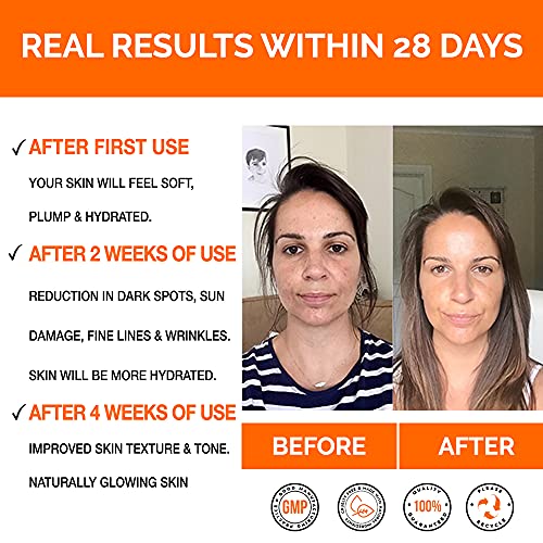 ViolaSkin Vitamin C Serum for Youthful Skin