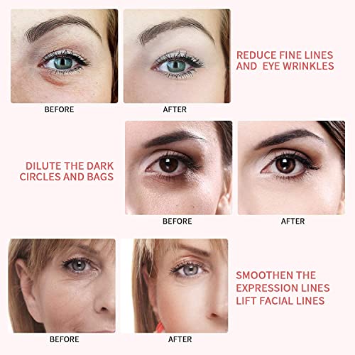 Retimax 1500 Retinol Anti-Aging Ointment, 30g