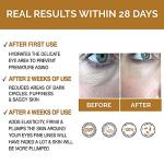 Premium Anti-Aging Eye Serum for Dark Circles