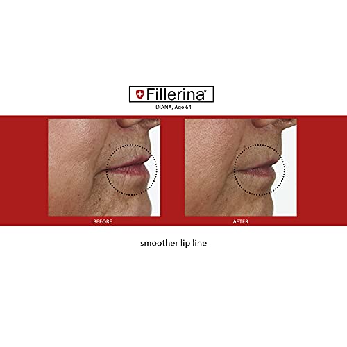 Fillerina 12 Densifying Filler for Youthful Skin