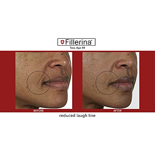 Fillerina 12 Densifying Filler for Youthful Skin