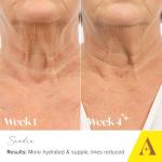 Collagen Deep Lift Neck & Décolleté Cream