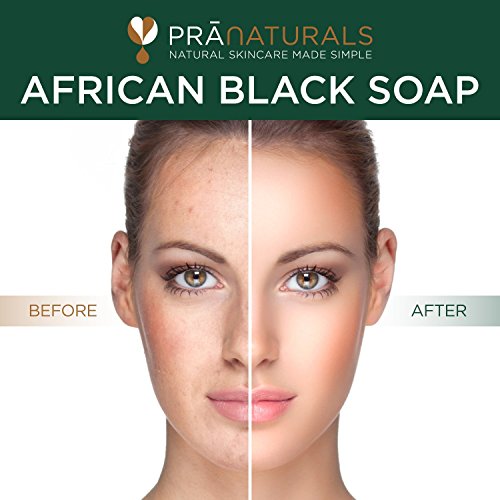 PraNaturals African Black Soap – Natural Anti-Aging Cleanser