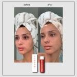 Byneta Medium Spray Foundation - Evens Skin Tone