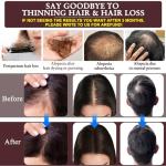 Rosemary Oil Hair Growth Serum & Shampoo