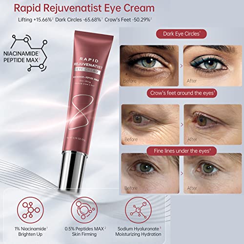 Tongyend Eye Cream for Dark Circles and Puffiness