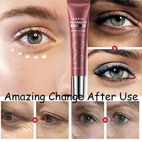 Tongyend Eye Cream for Dark Circles and Puffiness