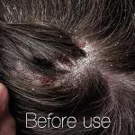 Hydrating Scalp Serum with Hyaluronic Acid & Melatonin