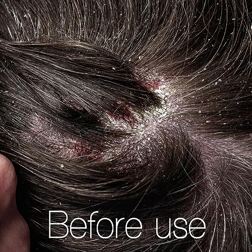 Hydrating Scalp Serum with Hyaluronic Acid & Melatonin