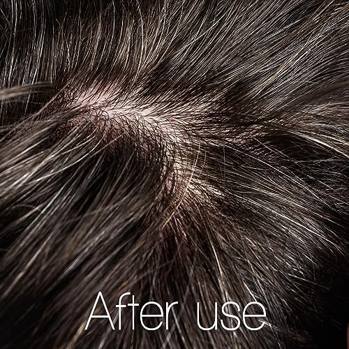 Hydrating Scalp Serum with Hyaluronic Acid & Melatonin