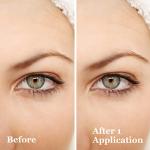 Revitalift Eye Cream for Dark Circles and Puffiness