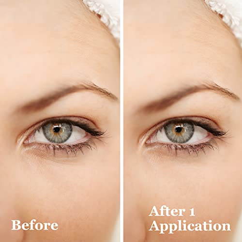 Revitalift Eye Cream for Dark Circles and Puffiness