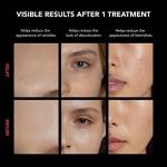 Smart LED Face Mask for Anti-Aging Treatment