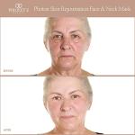 LED Face & Neck Mask for Anti-Aging and Acne